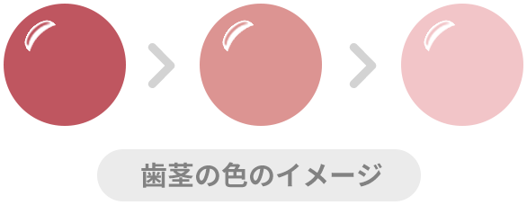 歯茎の色のイメージ