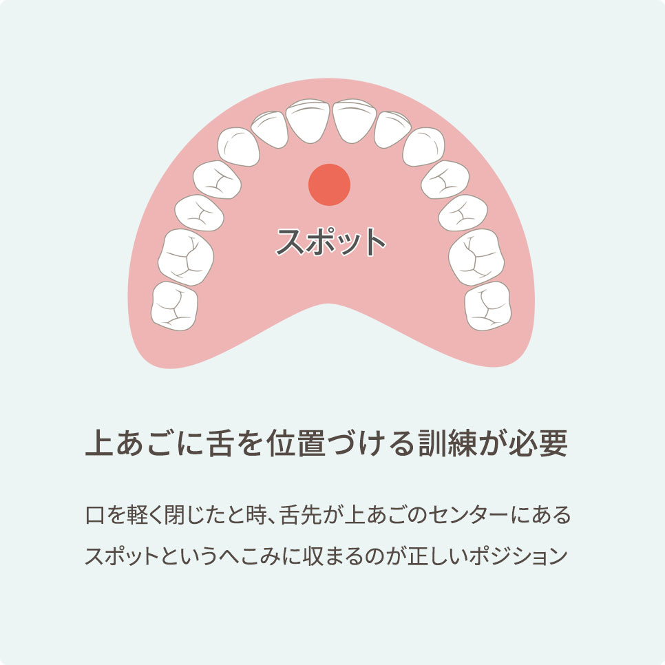 健康の “舌の位置を治す
