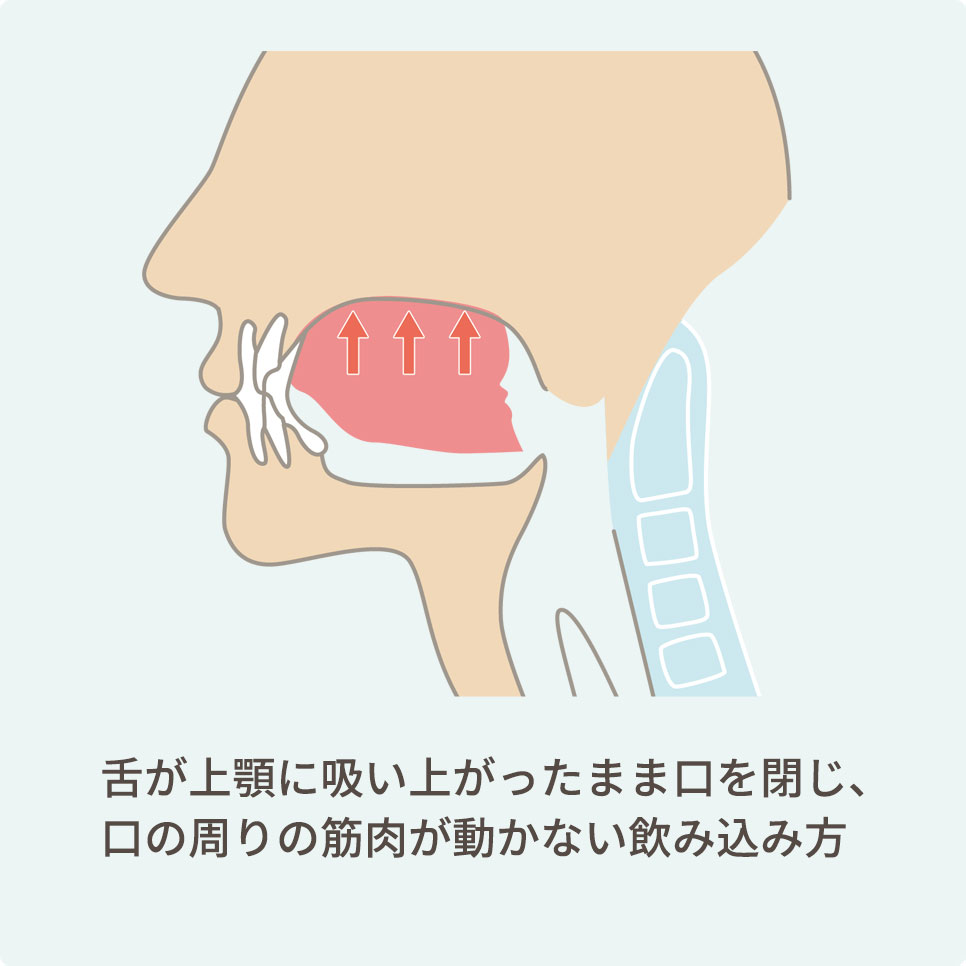 健康の “備え” を創る「予防」のメッセージ