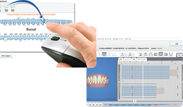 SDソフトウェアを使った最新治療