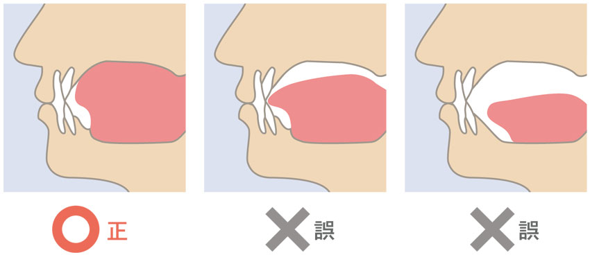 舌の位置を治す