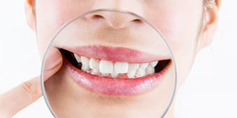 デンタルリテラシー